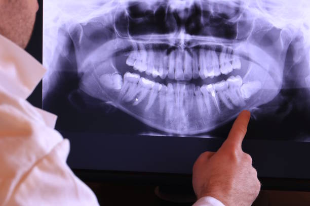 Best Emergency Treatment for Dental Infections or Abscesses in Worthington, OH
