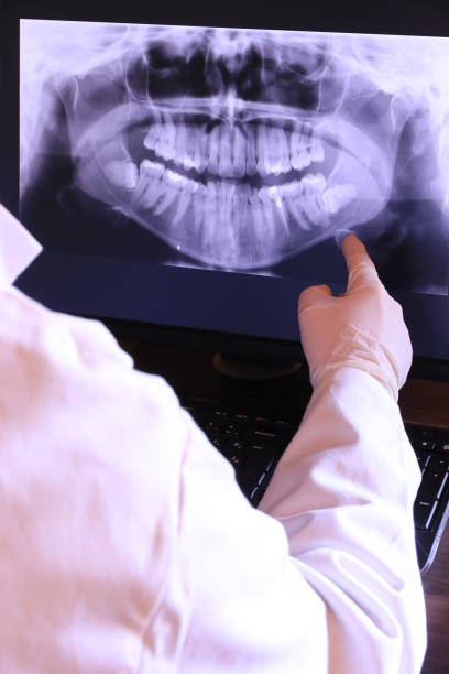 Best Emergency Tooth Extraction in Worthington, OH